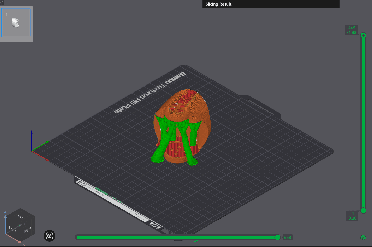 Sliced preview of ElbowJointRight