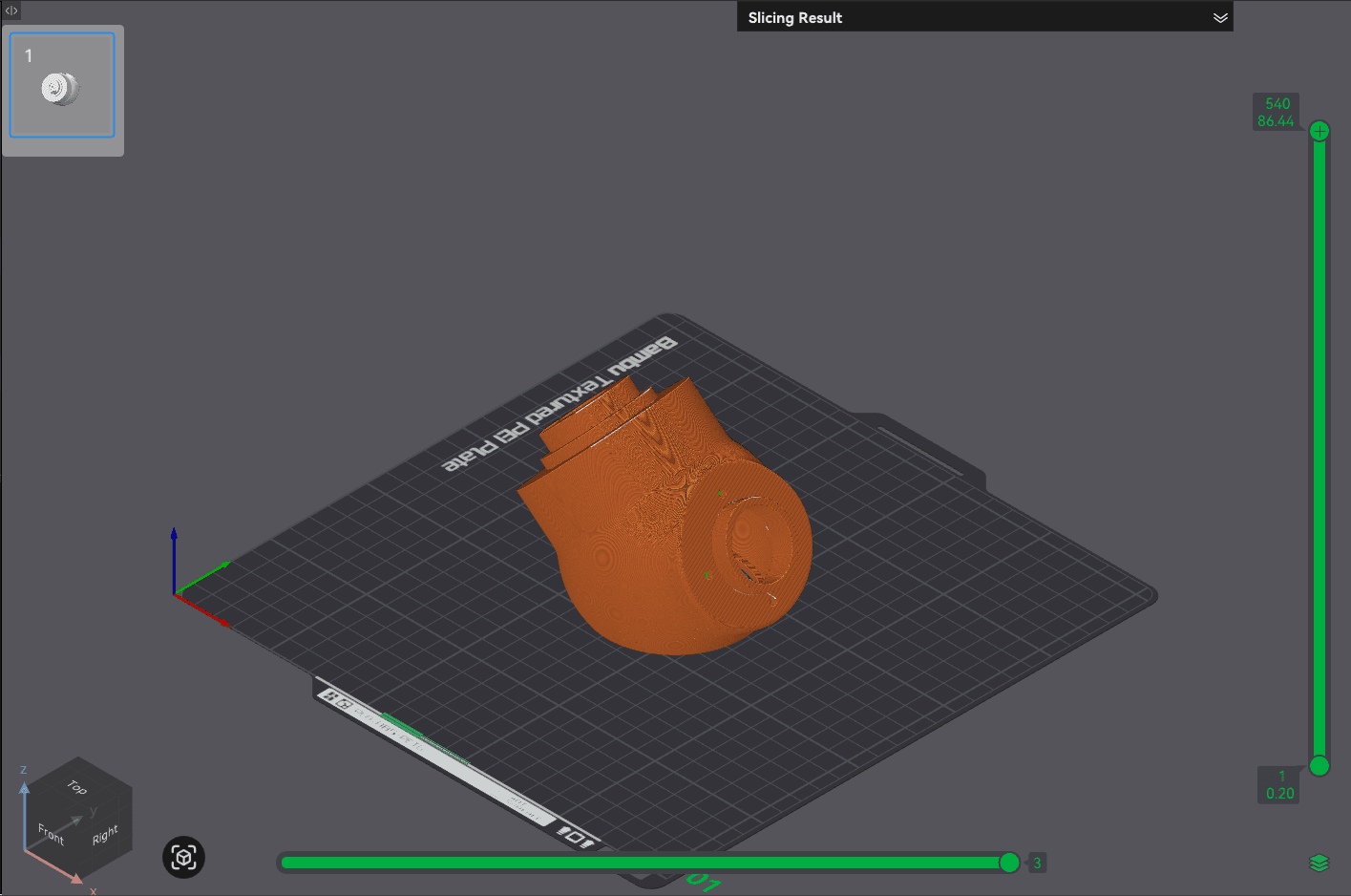 Sliced preview of ShoulderJointRight