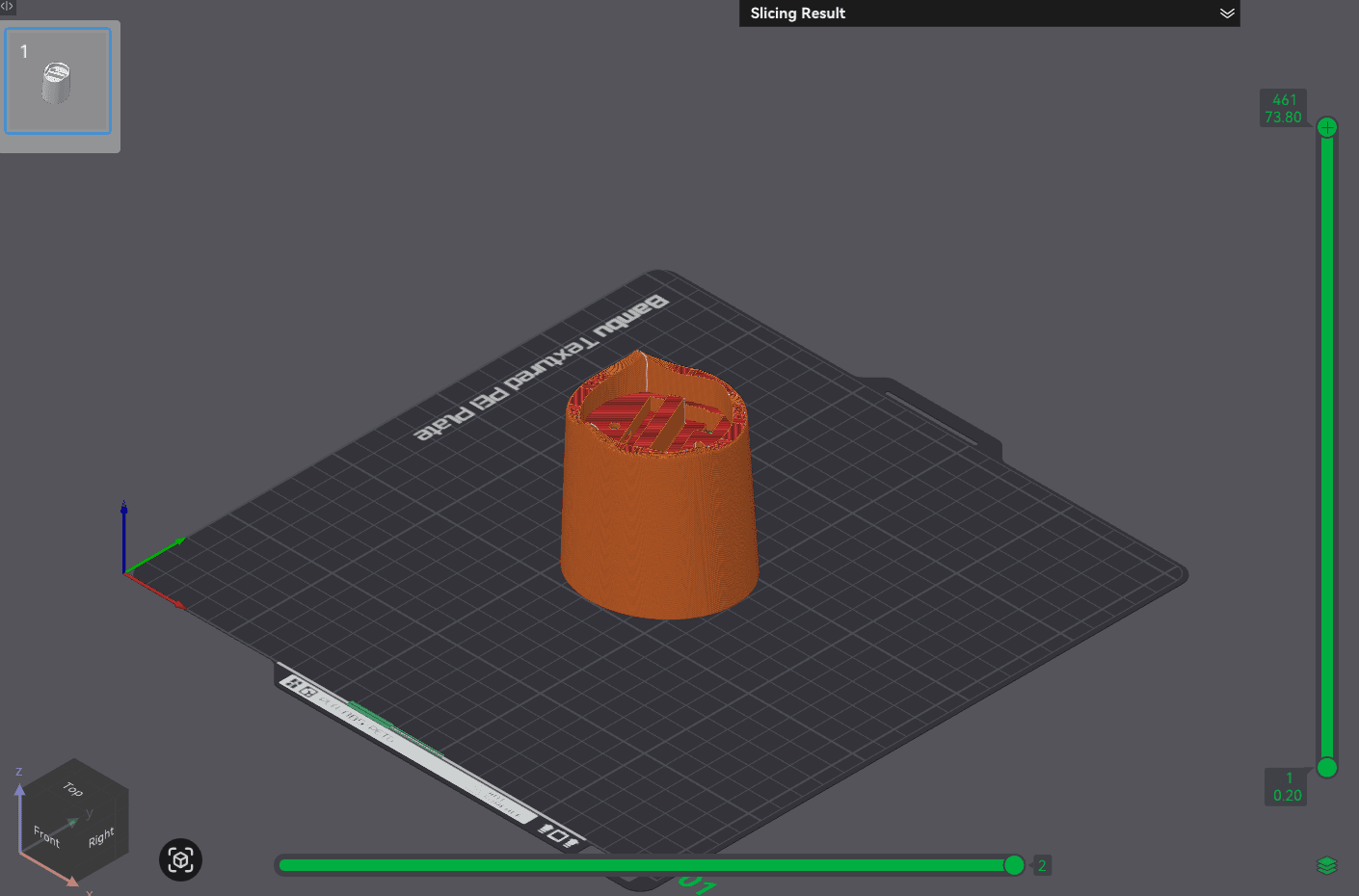 Sliced preview of UpperArmRight