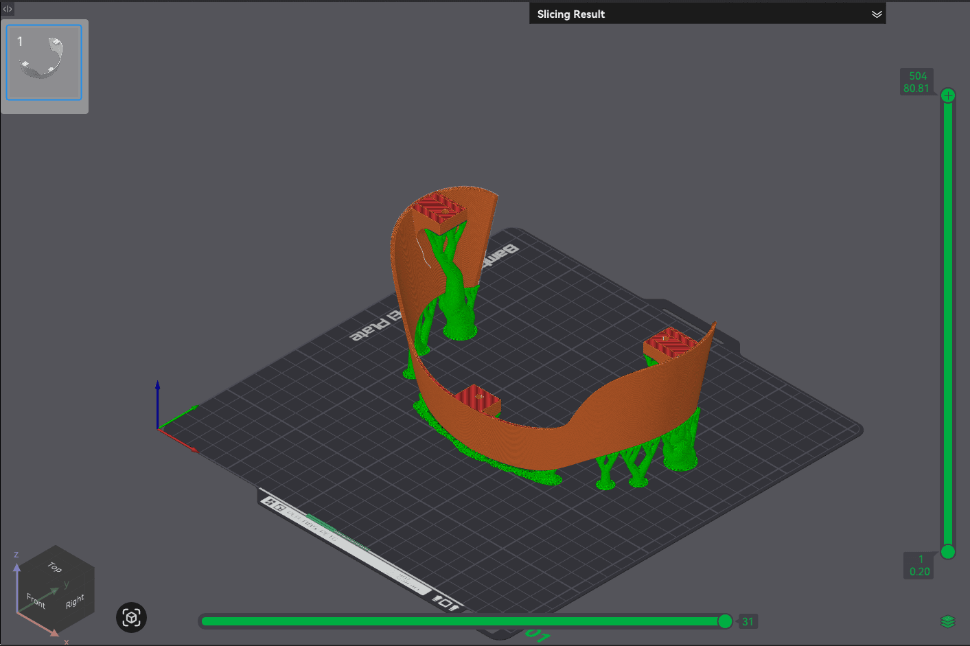 Sliced preview of UpperFrontLower