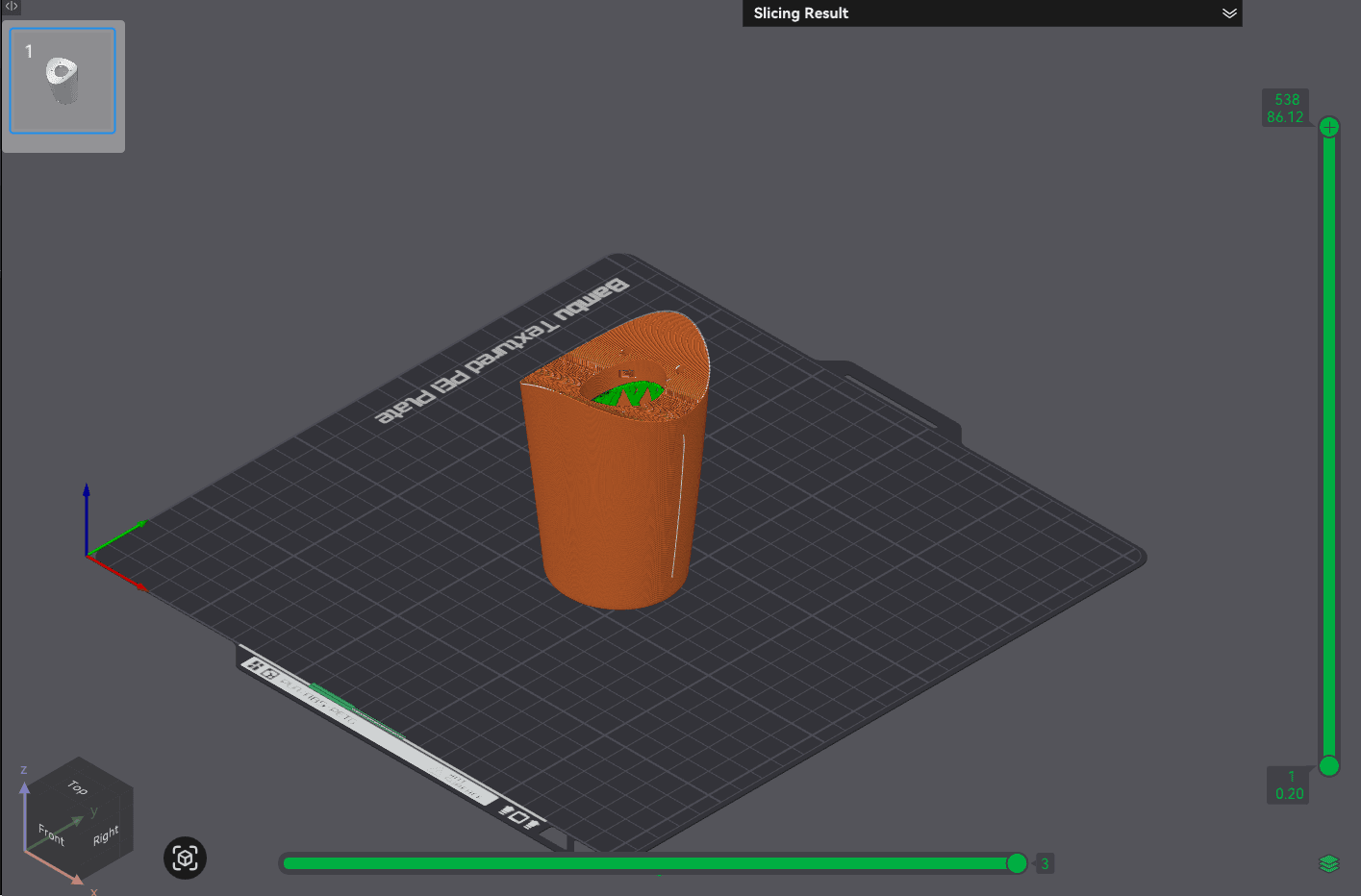 Sliced preview of WristJointLeft